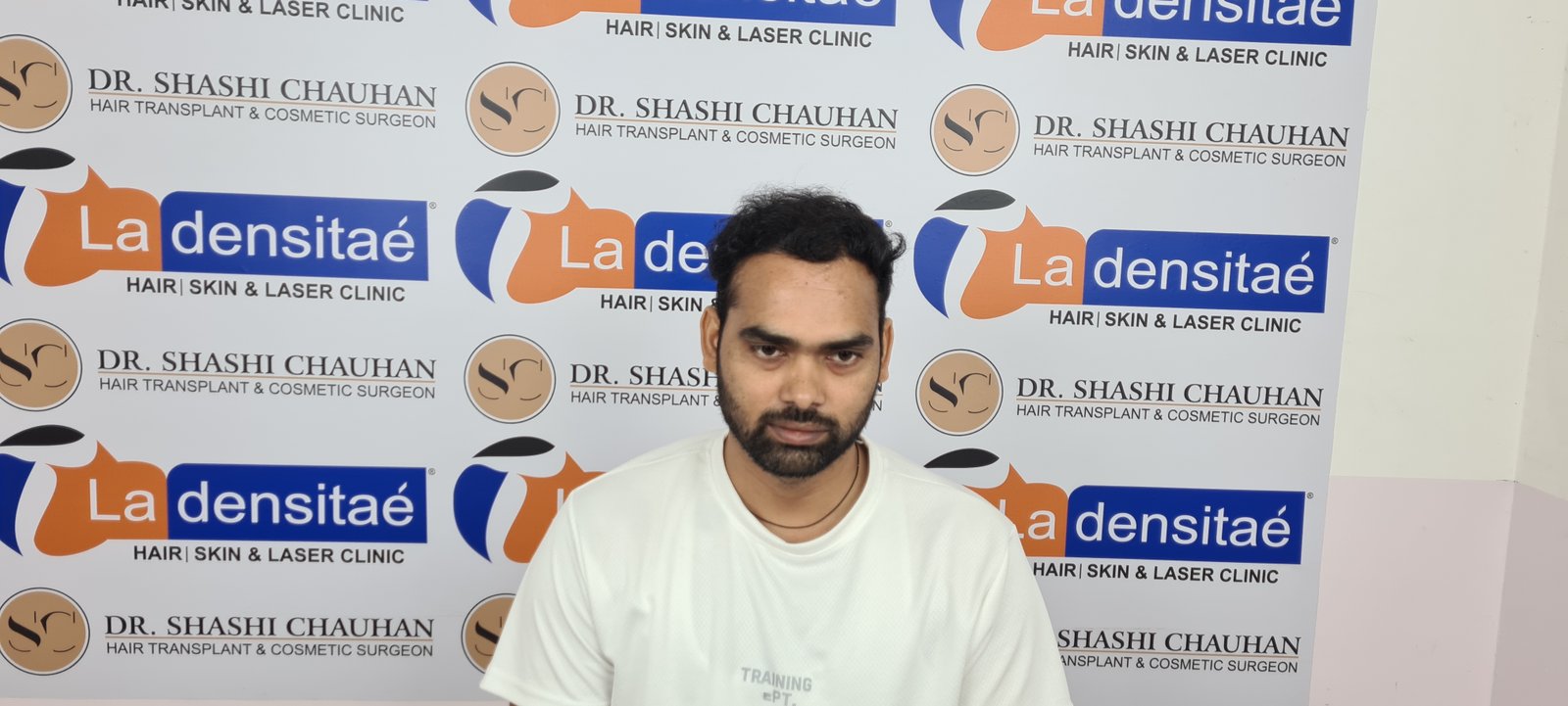 Anesh Kumar After Hair Transplant